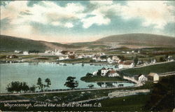 Bras D'Or Lakes Whycocomagh, NS Canada Nova Scotia Postcard Postcard