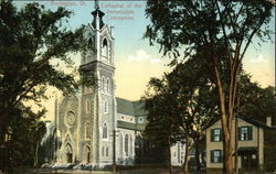 Cathedral of the Immaculate Conception Postcard