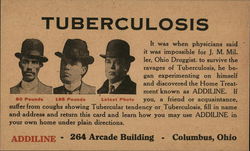 Addiline Tuberculosis Treatment Postcard