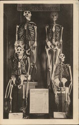 Four Skeletons With Printed Information on Display Death Postcard Postcard