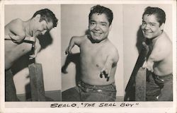 Sealo - The Seal Boy Sideshow Small Arms/Hands Circus Postcard Postcard Postcard