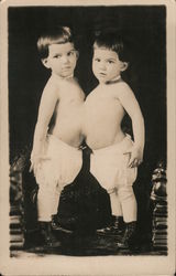 Siamese Twin boys conjoined at the chest pose in bloomers and boots Postcard