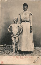 Sideshow: Leopard Skin Kaffir Child with his Mother A Freak of Nature Circus Postcard Postcard Postcard