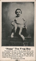 Sideshow: "Hopp" the Frog Boy Circus Postcard Postcard Postcard